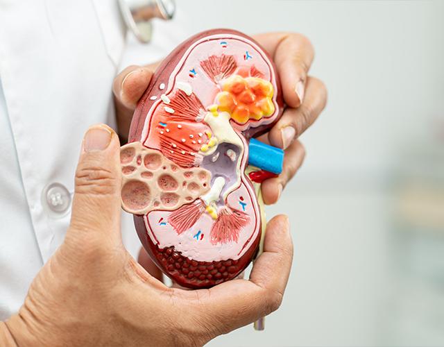 Bartter Syndrome