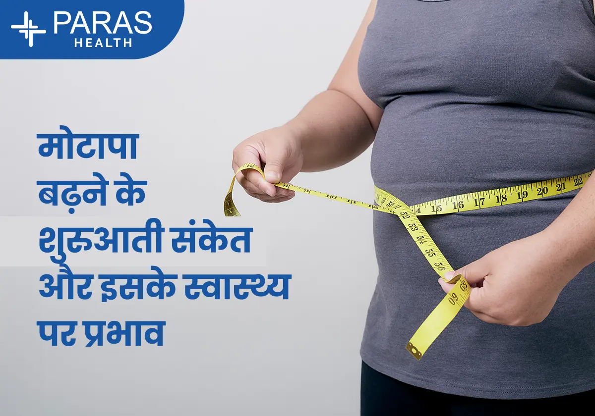 मोटापा (Obesity)