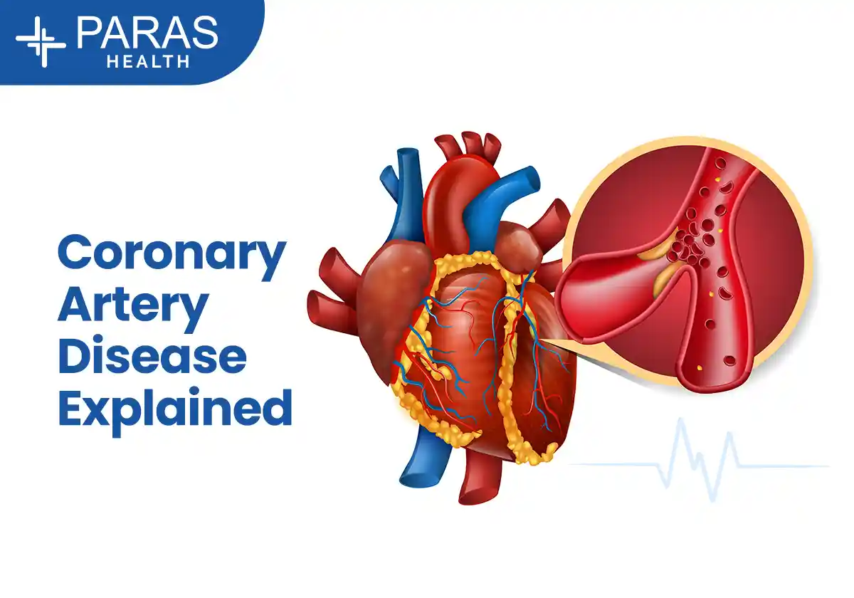 Coronary Artery Disease (CAD)