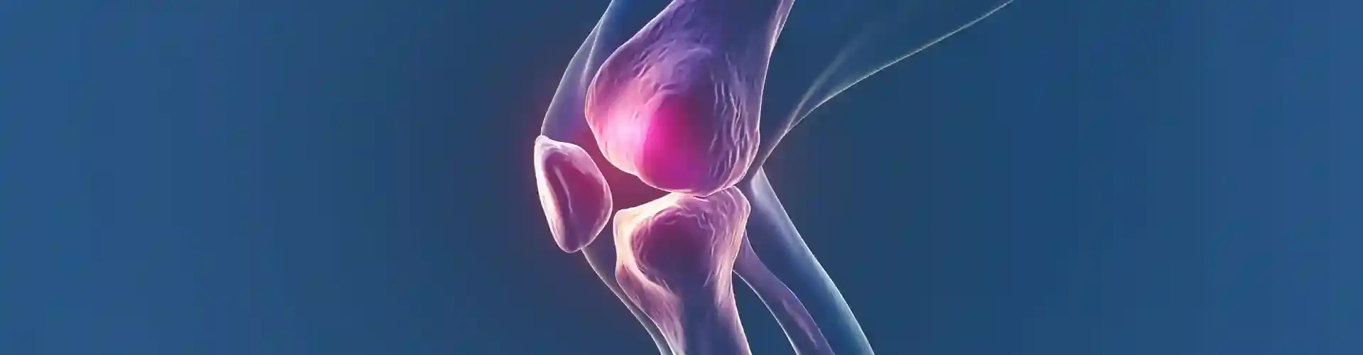 Shoulder Arthroscopy