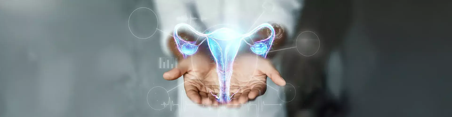 Cystocele Repair Surgery