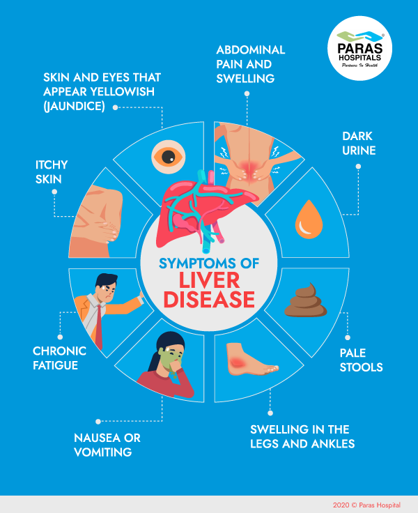 Symptoms of Liver Disease