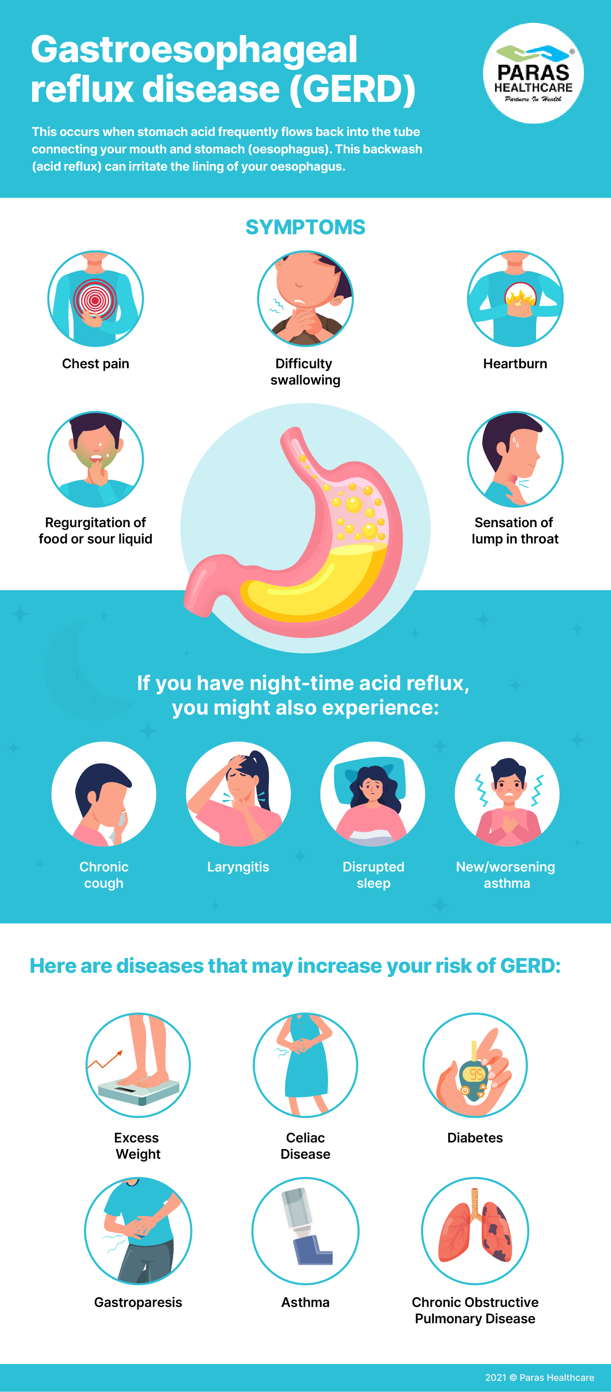 Symptoms of Gastroesophageal Reflux Disease (GERD)