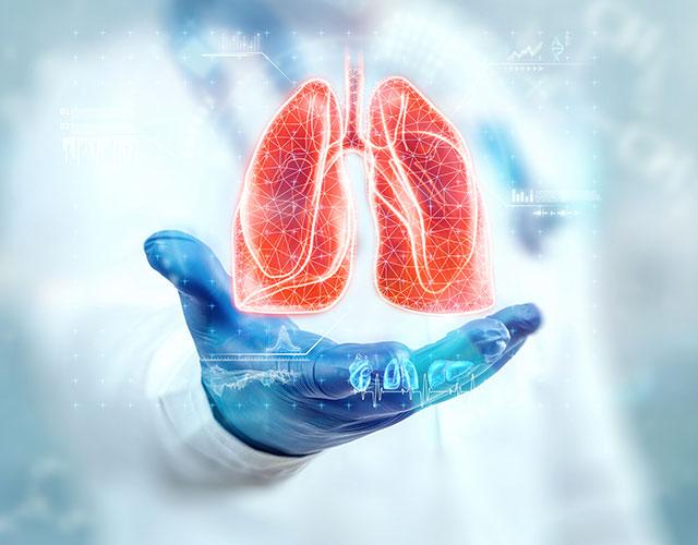 Pneumonia