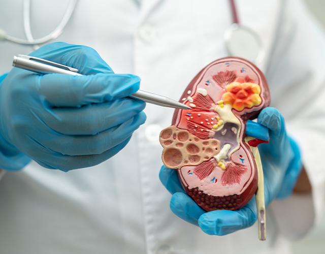 Endourology and Stone Disease